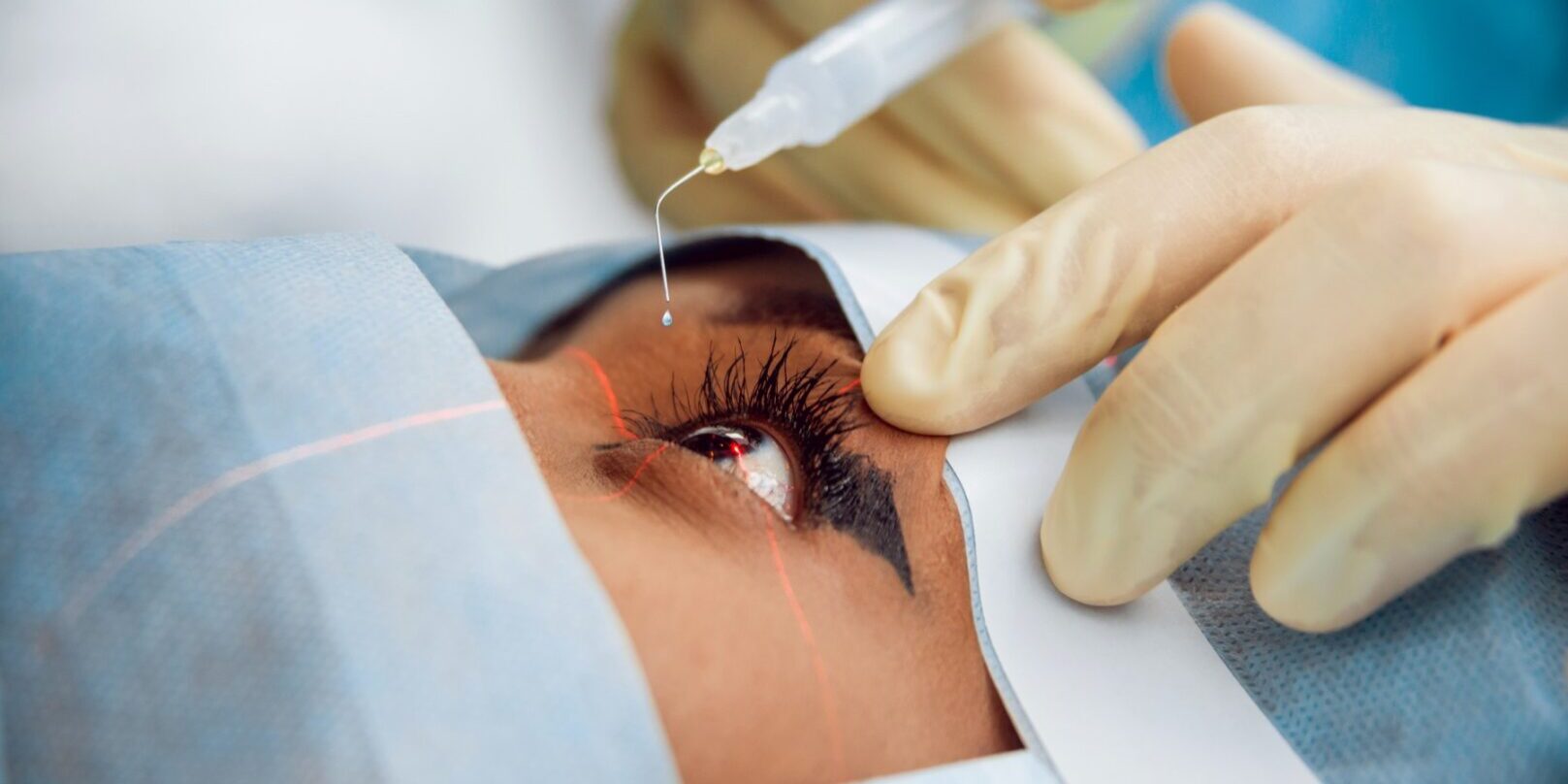 1920_cataract